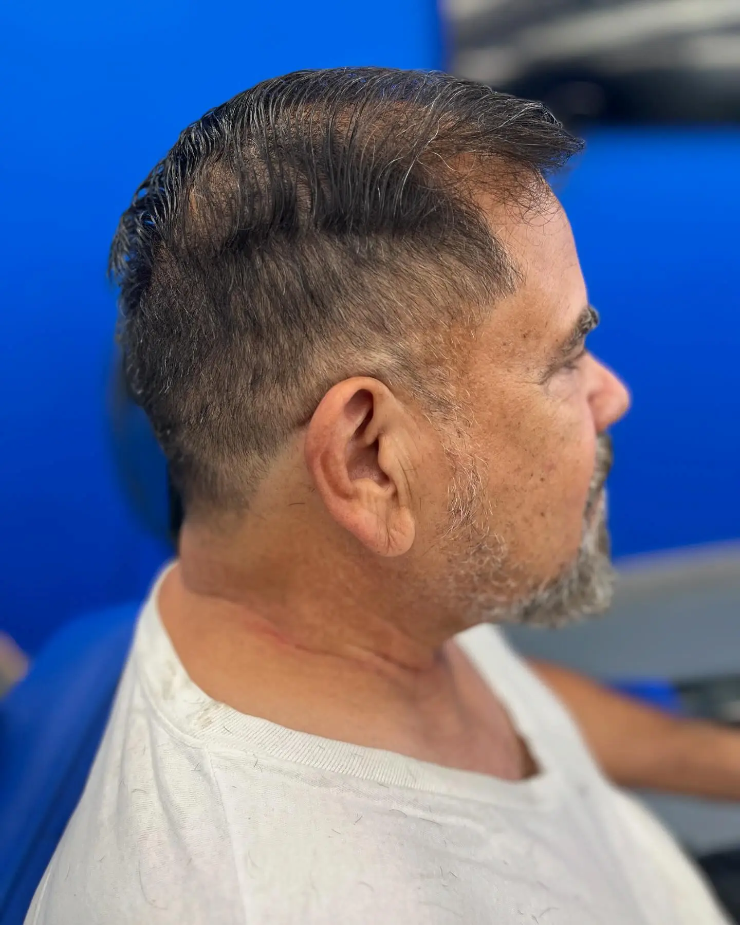 hombre de perfil con calva cubierta por pelo